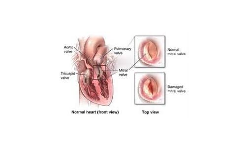 Valve Repairs & Replacements